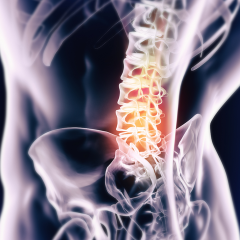 X-ray style illustration of a spine glowing red in the lower back